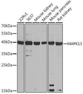 Anti-p38 delta/MAPK13 Rabbit Polyclonal Antibody