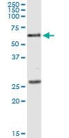 Anti-POLK Antibody Pair