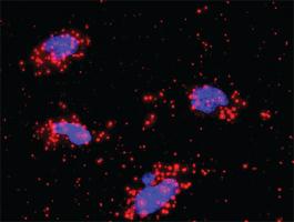 Anti-PRKCB + IKBKB Antibody Pair