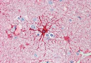 Anti-GFAP Antibody (A83720) (5 µg/ml) staining of paraffin embedded Human Cortex Steamed antigen retrieval with citrate buffer pH 6, AP-staining