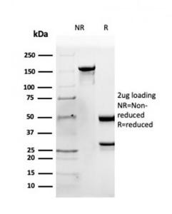 SDS-PAGE analysis of Anti-Apolipoprotein B Antibody [APOB/4333] under non-reduced and reduced conditions; showing intact IgG and intact heavy and light chains, respectively. SDS-PAGE analysis confirms the integrity and purity of the antibody