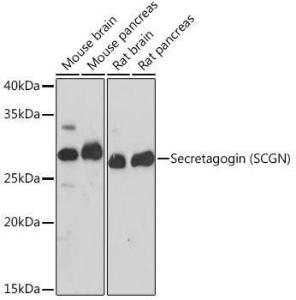 Western blot analysis of extracts of various cell lines, using Anti-SCGN / Secretagogin Antibody [ARC2196] (A306306) at 1:1000 dilution