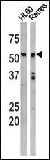 Anti-TP53 Rabbit Polyclonal Antibody