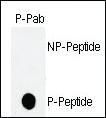 Anti-hGCN5 Rabbit Polyclonal Antibody