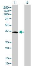 Anti-XPA Rabbit Polyclonal Antibody