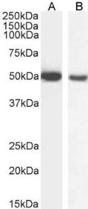 Anti-GFAP Antibody (A83720) (01 µg/ml) staining of Mouse (A) and (001 µg/ml) Rat (B) Brain lysate (35 µg protein in RIPA buffer) Detected by chemiluminescence