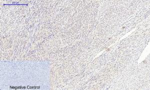 Immunohistochemical analysis of paraffin-embedded human uterus tissue using Anti-MIF Antibody at 1:200 (4°C overnight). Negative control was secondary antibody only