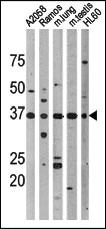 Anti-TP53 Rabbit Polyclonal Antibody