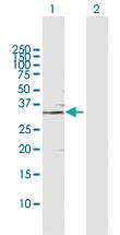 Anti-GMPR Rabbit Polyclonal Antibody