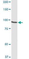 Anti-AKAP8 Polyclonal Antibody Pair