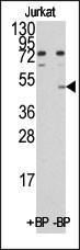 Anti-MINA Rabbit Polyclonal Antibody (FITC (Fluorescein))