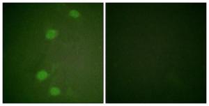 Immunofluorescence analysis of HeLa cells using Anti-Retinoblastoma (phospho Ser249) Antibody. The right hand panel represents a negative control, where the antibody was pre-incubated with the immunising peptide