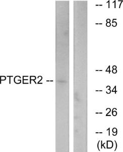 Antibody anti-PTGER2 A96770-100 100 µg