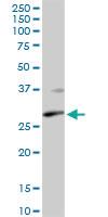 Anti-XPA Rabbit Polyclonal Antibody