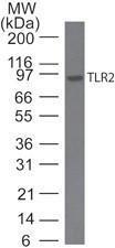 Anti-TLR2 Rat Monoclonal Antibody [clone: 11G5]