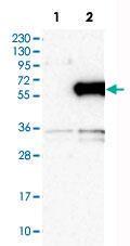 Anti-E2F1 Rabbit Polyclonal Antibody