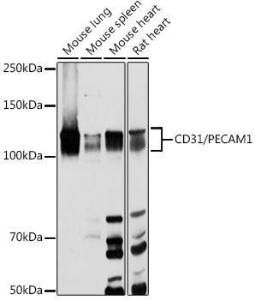 Western blot analysis of extracts of various cell lines, using Anti-CD31 Antibody (A309205) at 1:1,000 dilution. The secondary antibody was Goat Anti-Rabbit IgG H&L Antibody (HRP) at 1:10,000 dilution.