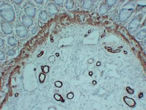 Antibody anti-smooth muscle actin ABT-S