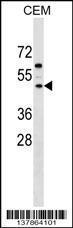 Anti-FBXL8 Rabbit Polyclonal Antibody (Biotin)