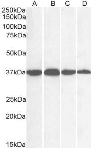 Anti-GAPDH Goat Polyclonal Antibody