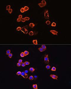 Immunofluorescence analysis of RAW264. 7 cells using Anti-CD14 Antibody (A9747) at a dilution of 1:100. DAPI was used to stain the cell nuclei (blue).