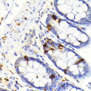 Immunohistochemistry analysis of paraffin-embedded human colon tissue using Anti-SCGN / Secretagogin Antibody [ARC2196] (A306306) at a dilution of 1:100 (40x lens)