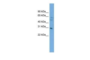 Anti-MRTO4 Rabbit Polyclonal Antibody