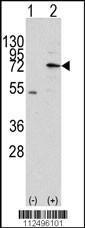 Anti-MIPEP Rabbit Polyclonal Antibody (AP (Alkaline Phosphatase))