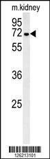 Anti-GNE Rabbit Polyclonal Antibody (APC (Allophycocyanin))