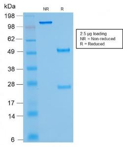 SDS-PAGE analysis of Anti-Kappa Light Chain Antibody [rKLC264] under non-reduced and reduced conditions; showing intact IgG and intact heavy and light chains, respectively. SDS-PAGE analysis confirms the integrity and purity of the antibody