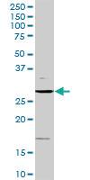 Anti-CCND3 Rabbit Polyclonal Antibody