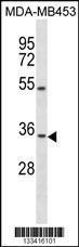 Anti-OSTM1 Rabbit Polyclonal Antibody (APC (Allophycocyanin))