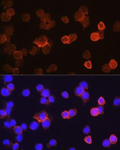 Immunofluorescence analysis of THP-1 cells using Anti-CD14 Antibody (A9747) at a dilution of 1:100. DAPI was used to stain the cell nuclei (blue).