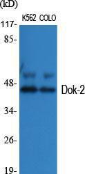 Western blot analysis of various cells using Anti-p56 Dok-2 Antibody