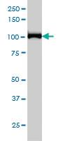 Anti-CNOT3 Mouse Monoclonal Antibody [clone: 4B8]