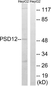 Western blot analysis of lysates from HepG2 cells using Anti-PSMD12 Antibody. The right hand lane represents a negative control, where the antibody is blocked by the immunising peptide