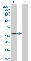 Anti-CCND3 Rabbit Polyclonal Antibody