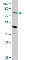 Anti-MUC4 Mouse Monoclonal Antibody [clone: 5B12]