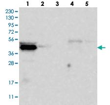 Anti-CARNMT1 Rabbit Polyclonal Antibody