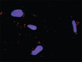 Anti-NFATC4 + MAPK14 Antibody Pair