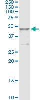 Anti-HGD Antibody Pair