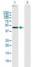 Anti-WDR19 Rabbit Polyclonal Antibody