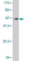 Anti-CDK4 Mouse Polyclonal Antibody