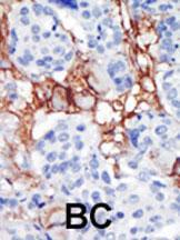 Anti-PIP4K2B Rabbit Polyclonal Antibody (APC (Allophycocyanin))