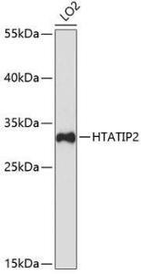 Western blot analysis of extracts of LO2 cells, using Anti-TIP30 Antibody (A9751) at 1:3,000 dilution