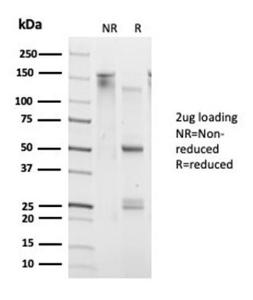 SDS-PAGE analysis of Anti-DAXX Antibody [PCRP-DAXX-6A8] under non-reduced and reduced conditions; showing intact IgG and intact heavy and light chains, respectively. SDS-PAGE analysis confirms the integrity and purity of the antibody.