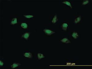 Anti-CNOT3 Mouse Monoclonal Antibody [clone: 4B8]