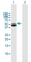 Anti-SERPINA12 Rabbit Polyclonal Antibody