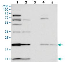 Anti-CHIC2 Rabbit Polyclonal Antibody