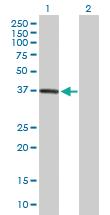 Anti-DPH5 Mouse Polyclonal Antibody